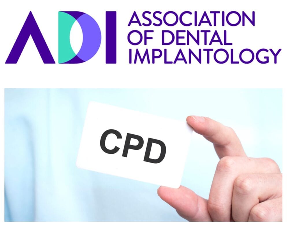 Exploring implantology with the ADI