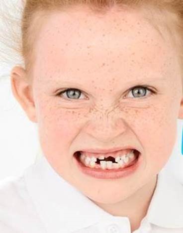 Aquafresh study finds half of children lack confidence in their smile