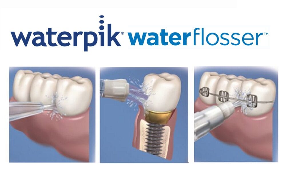 Interdental excellence at the BDCDS – Stand C49