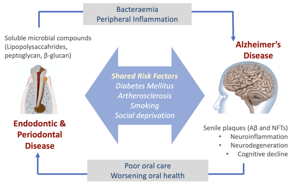 Exploring the link between oral diseases and Alzheimer’s Disease