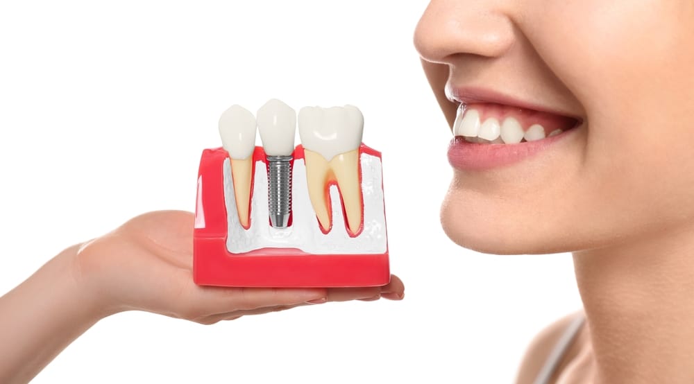 Supply implant patients with all they need