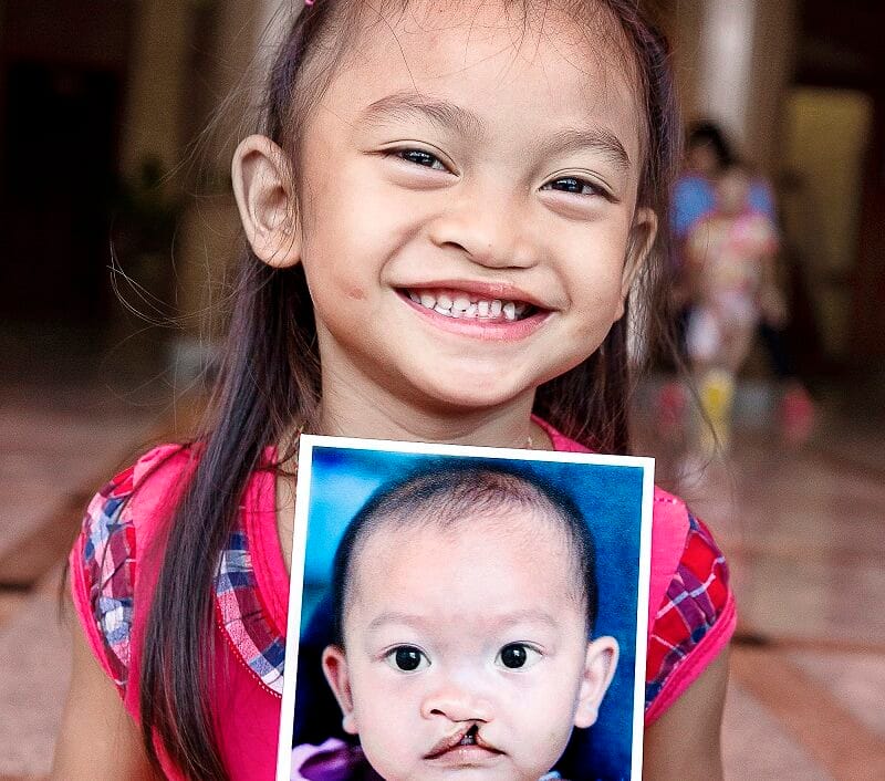 Operation Smile benefits from a significant legacy