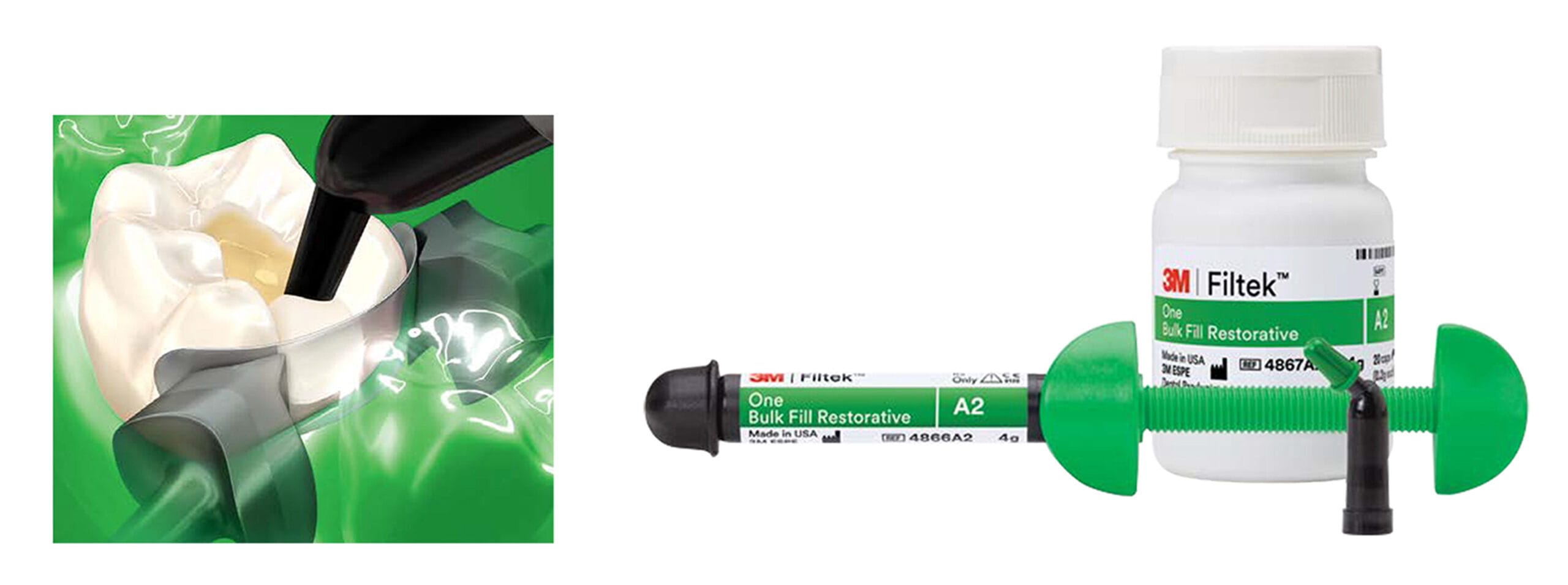 Filflex Compound The strongest bulk fill composite we have tested - The Probe
