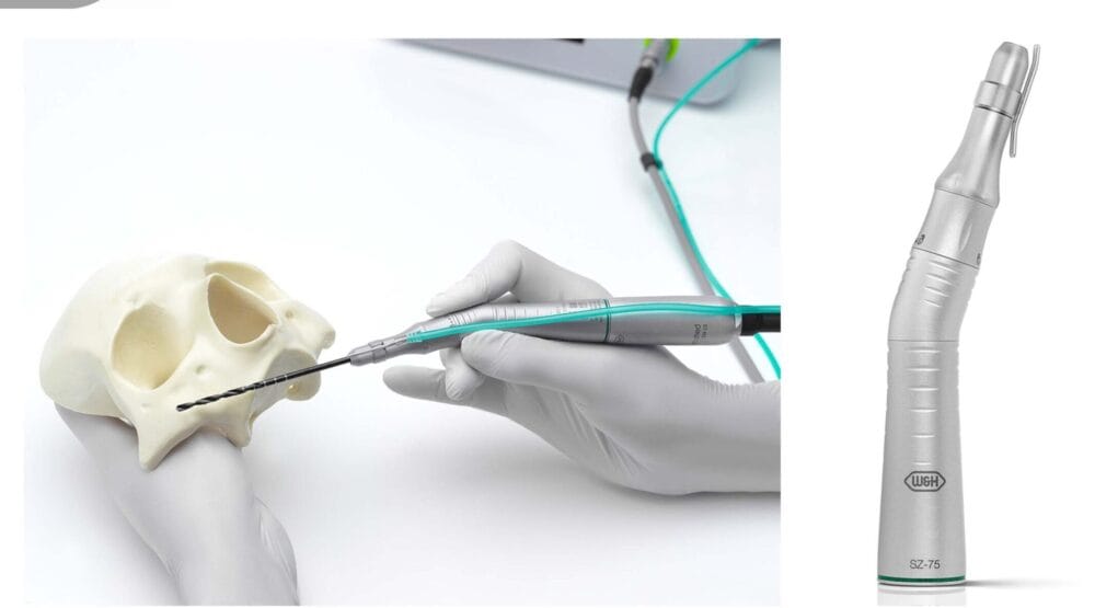 Zygomatic implants – life-changing results for cancer survivors