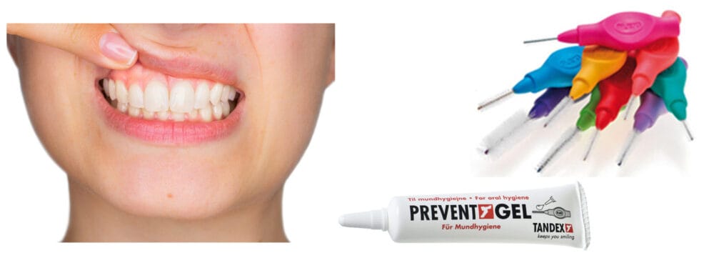Promote long-term oral health