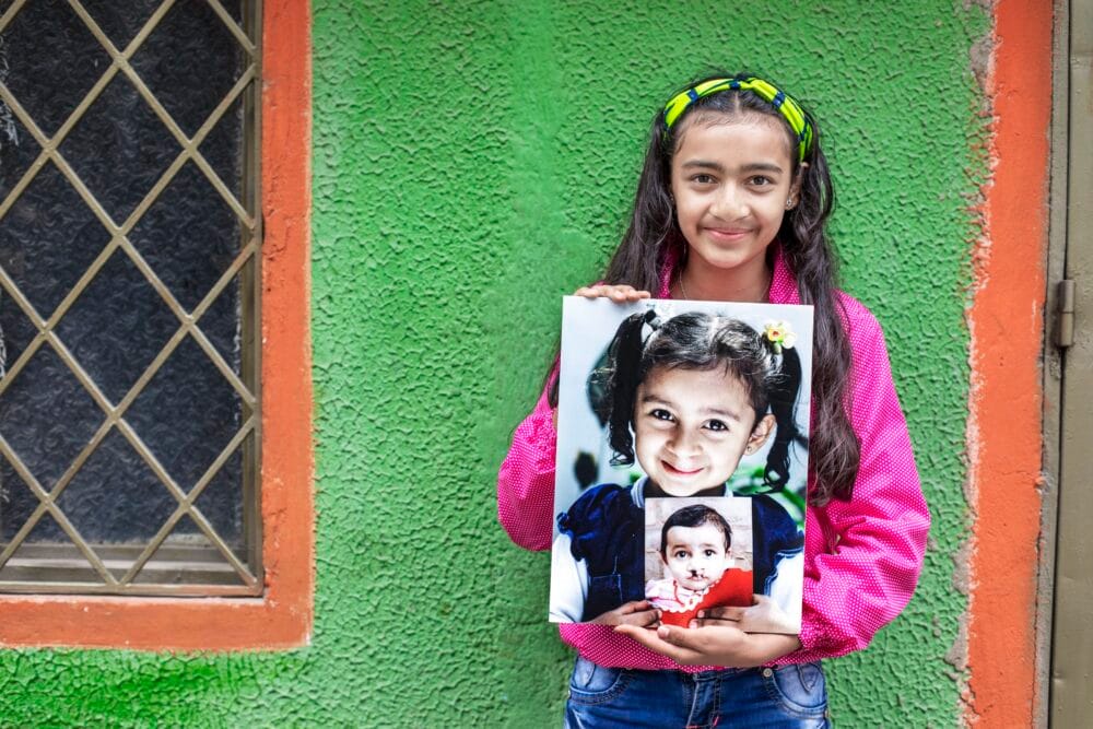 EAS provides a legacy with bite for children with cleft conditions