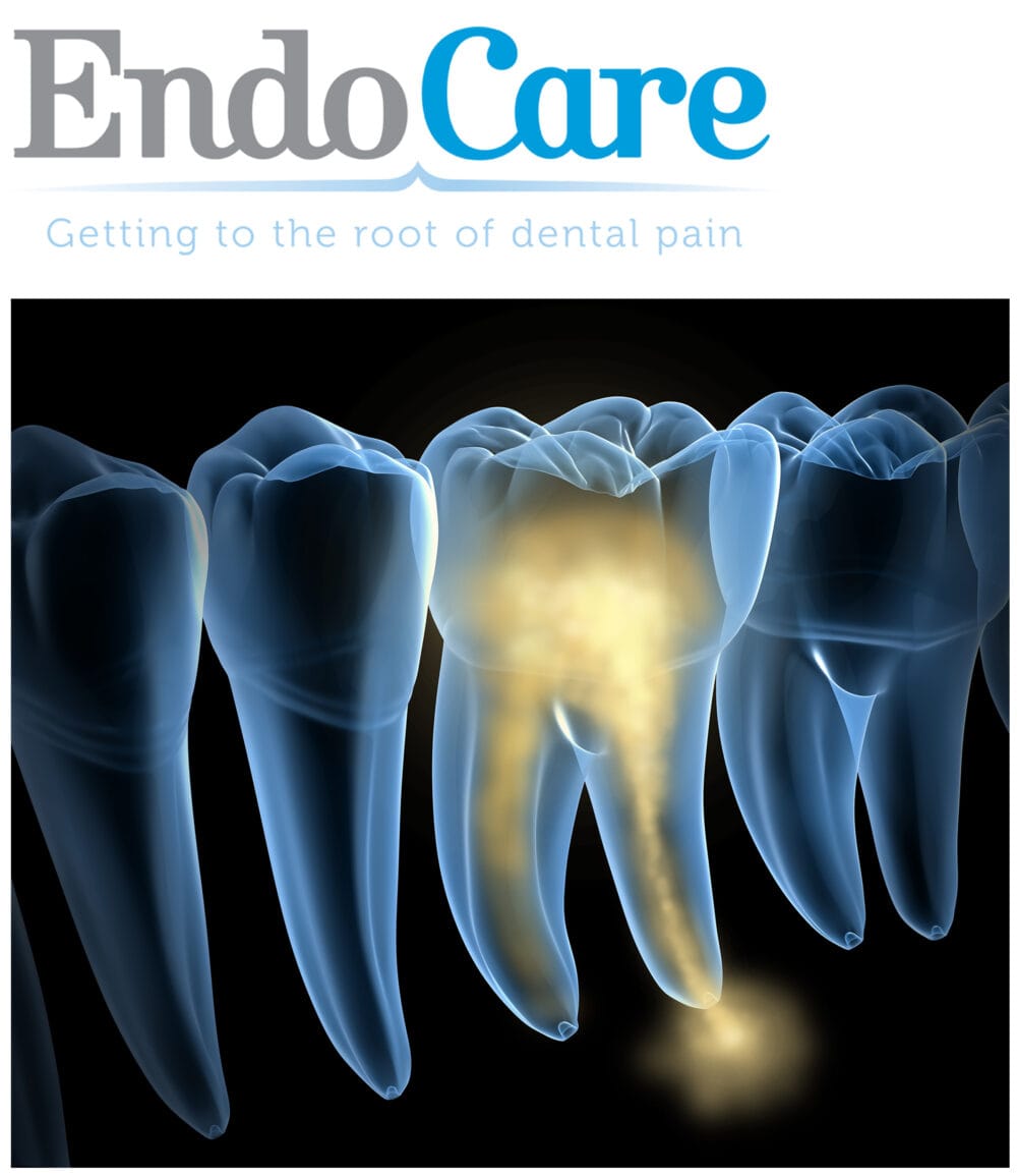 Supported diagnosis for dental pain