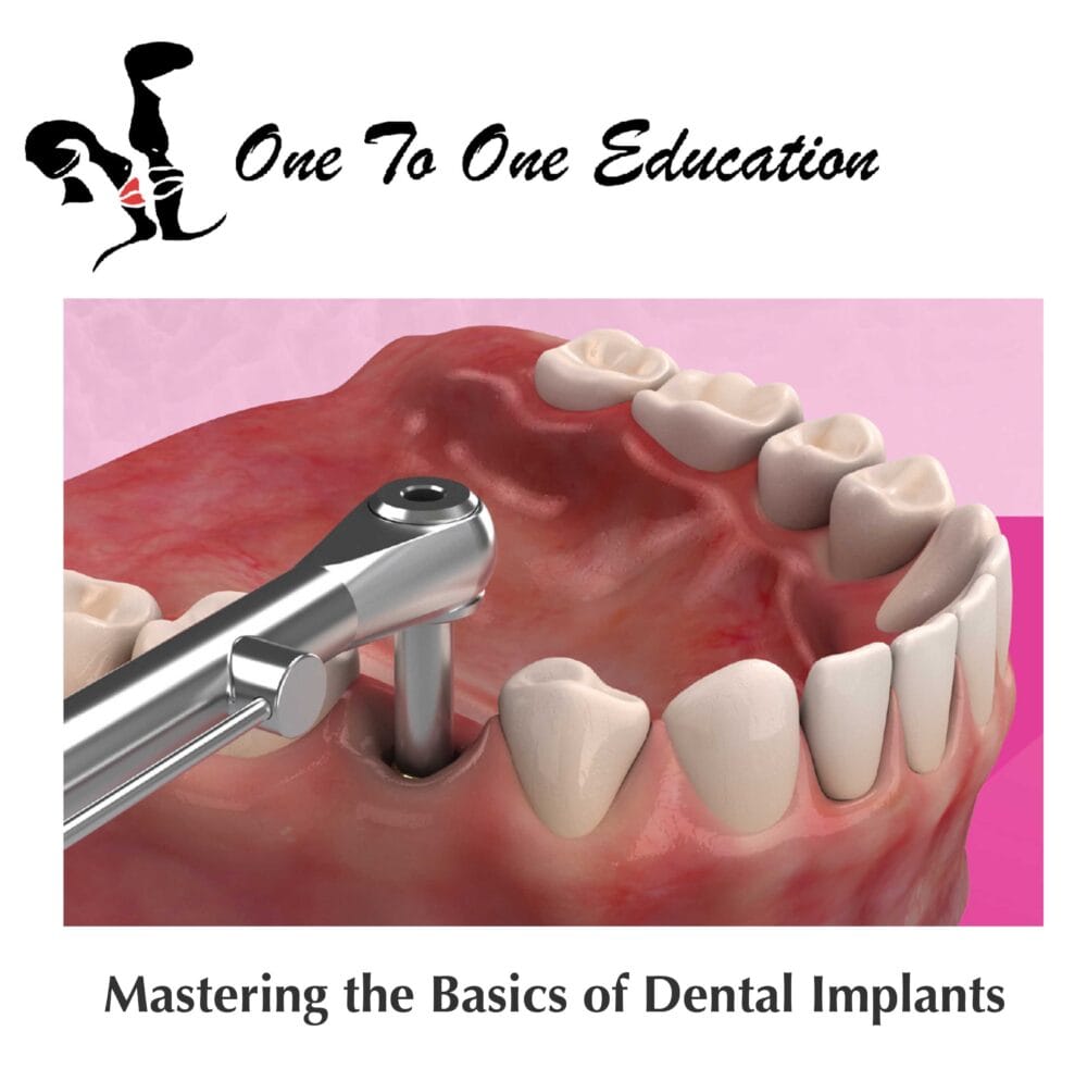 Elevate your implant skills