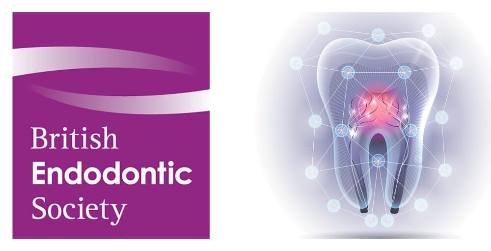 Are you interested in endodontics? Don’t miss out!