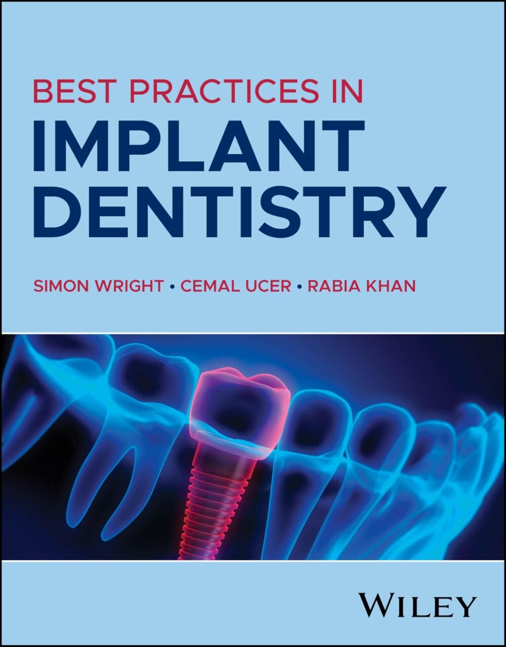 Get your guide to implantology!