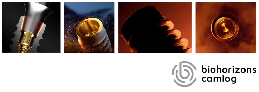 Find the right implant for you