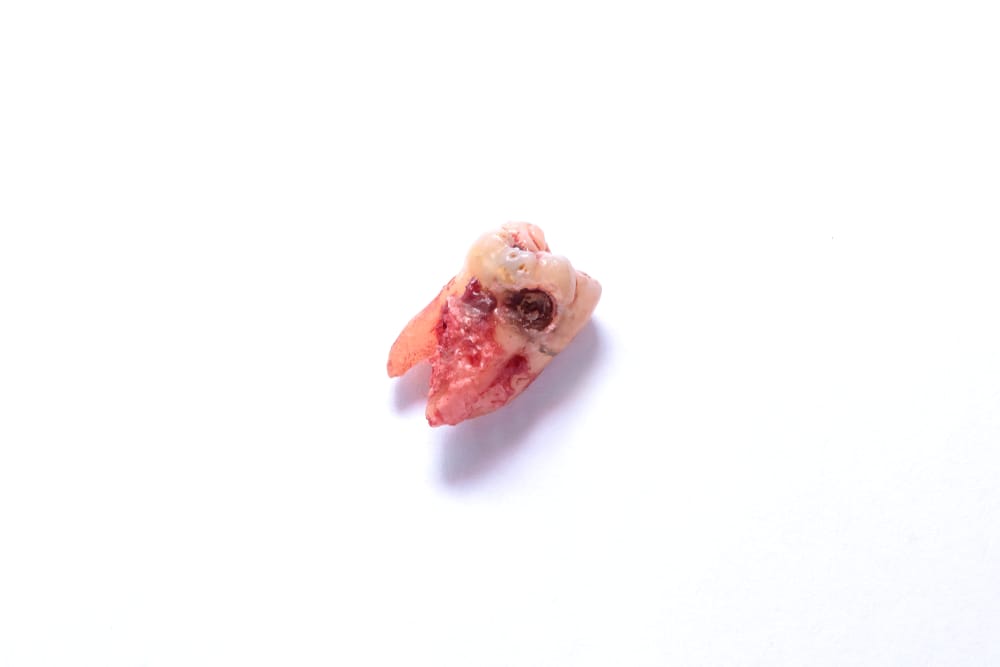 Differentiating anatomical waste