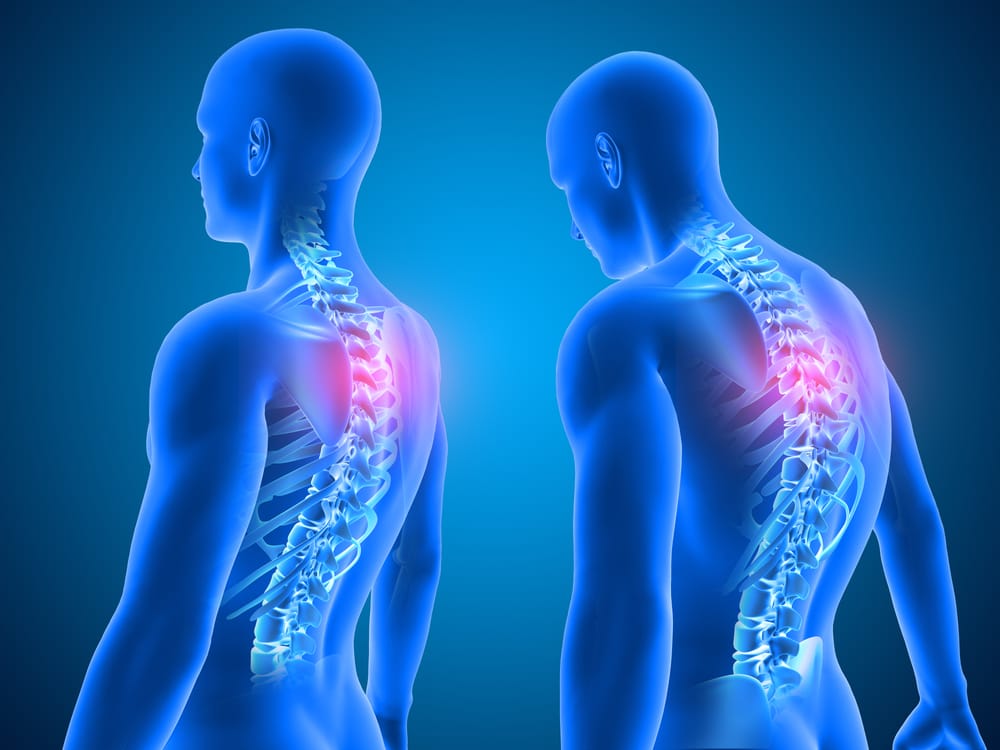 Poor posture and TMJ