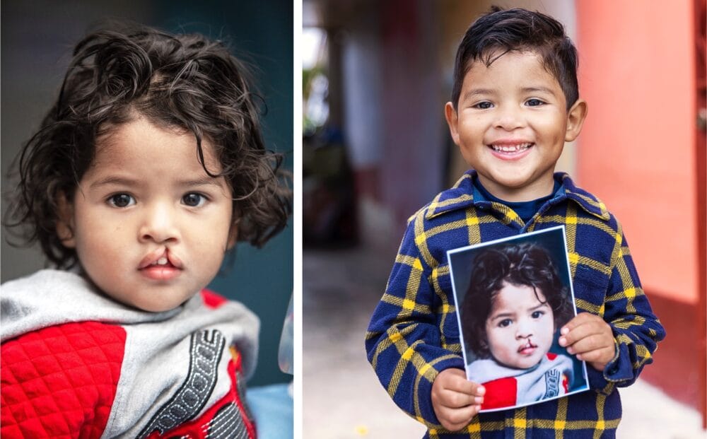 Superdrug and Oral B partner with Operation Smile