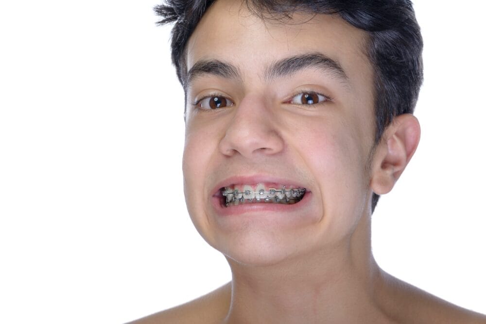 Is there a time limit on orthodontic care?