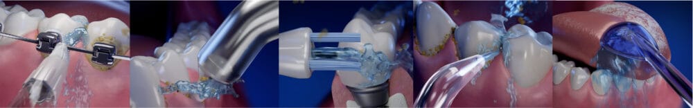 Simpler interdental cleaning support with Waterpik™