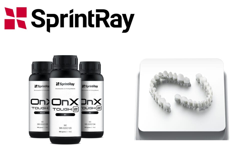 Fast and reliable 3D printing for dental restorations