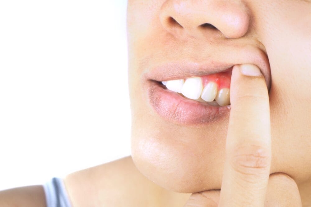Nine out of 10 Brits don’t realise that gum disease may be associated with Type 2 diabetes