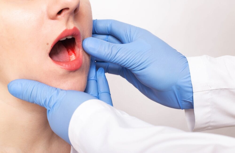 Mouth cancer cases in England hit record high as charity warns of ‘rising human cost’