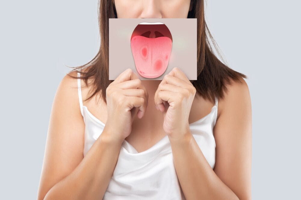 Living with mouth cancer costs patients over £2,000 a year, study finds