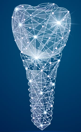 The digital world of implant dentistry