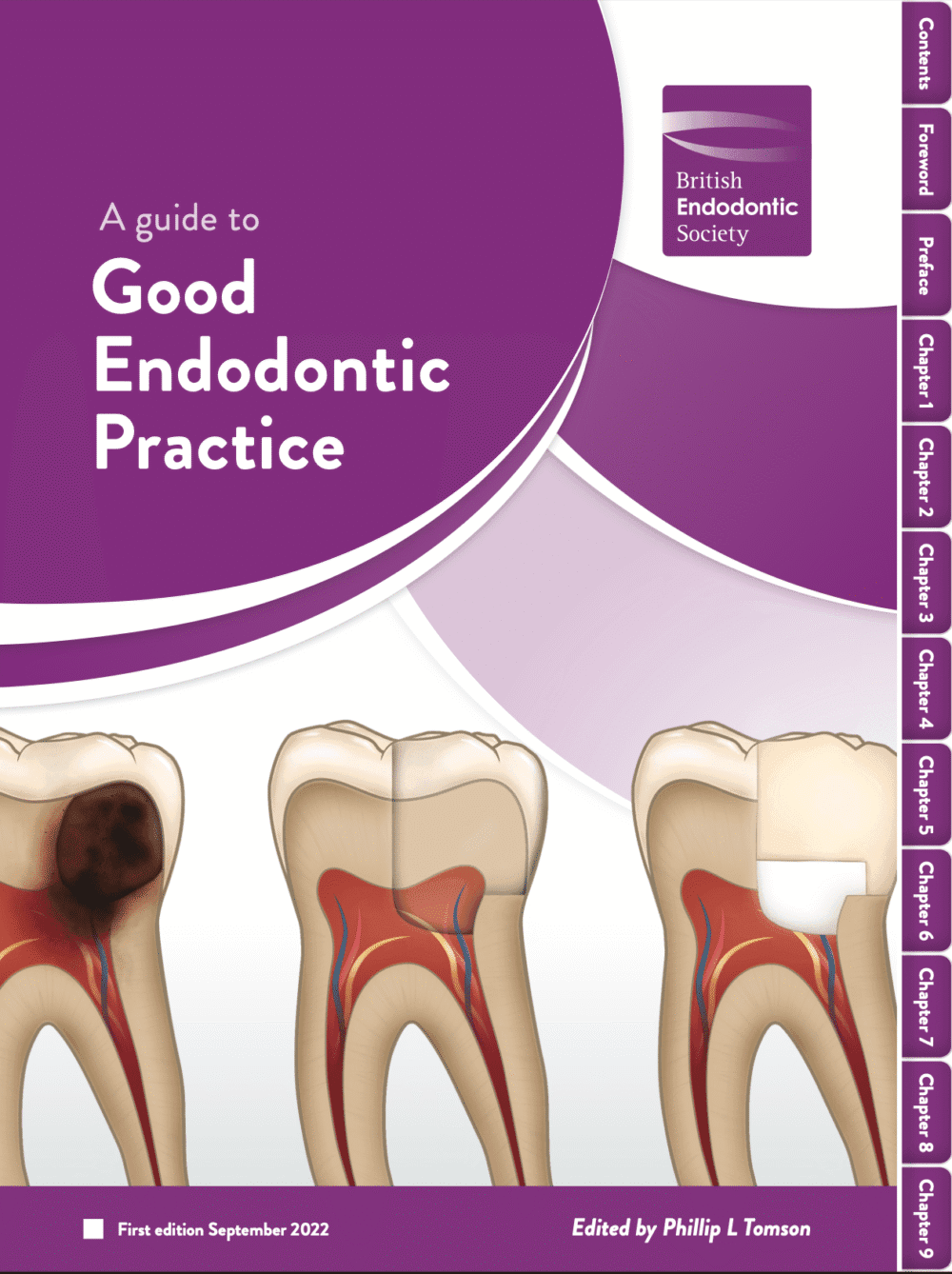 Anaesthetic failure in irreversible pulpitis: strategies for the general dental practitioner