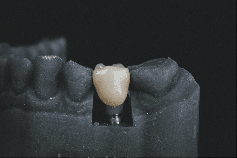 Metal microparticles – what’s the damage?