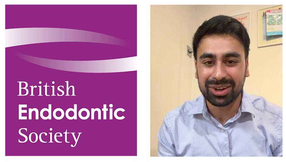 Share your endodontic cases
