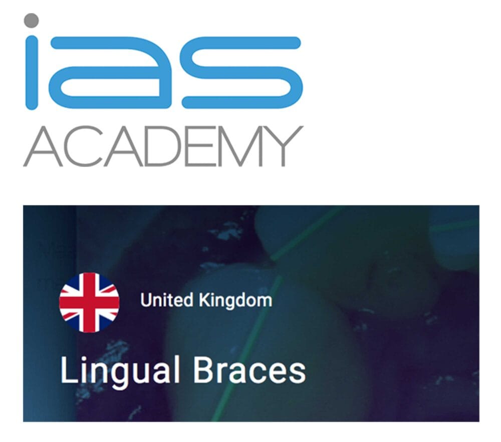 Understanding lingual orthodontics