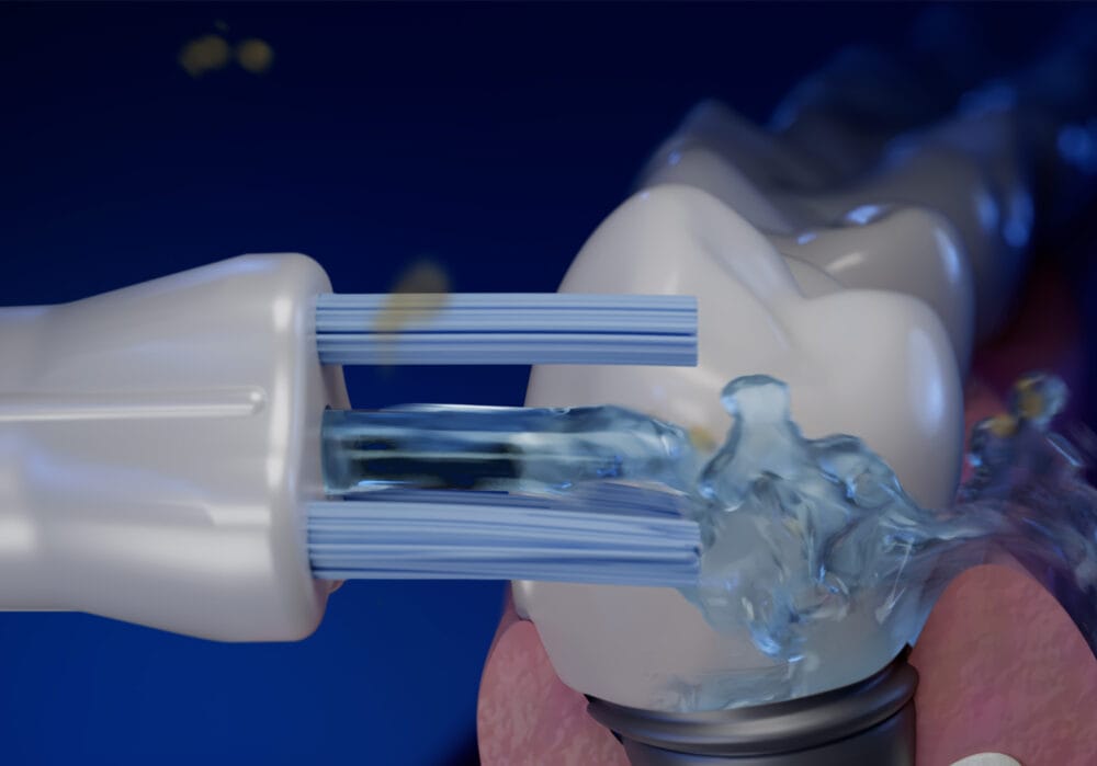 A water flosser for everyone