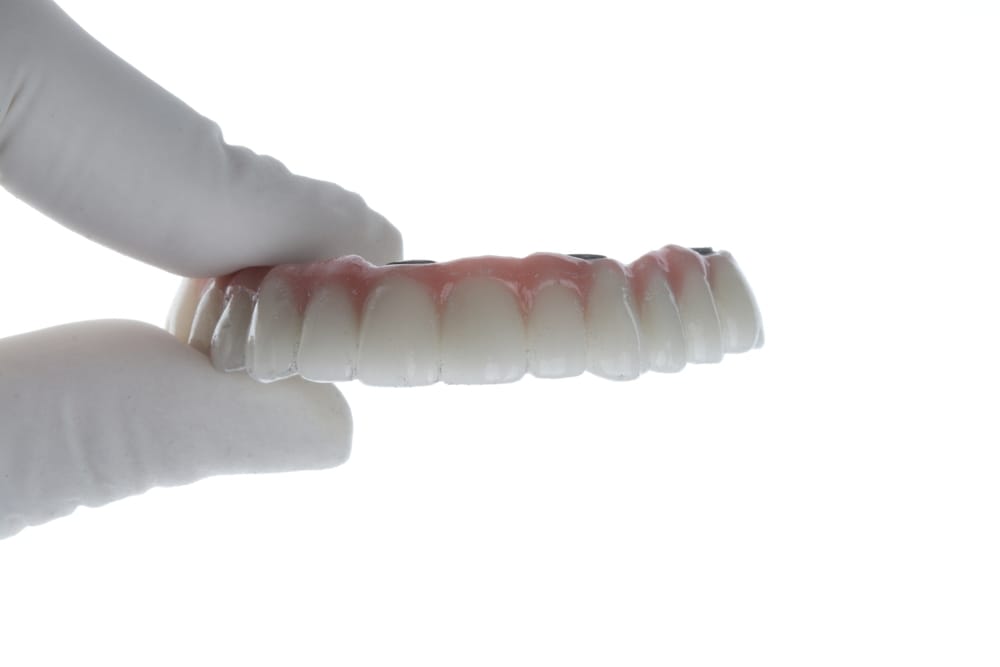Support throughout the full arch treatment plan