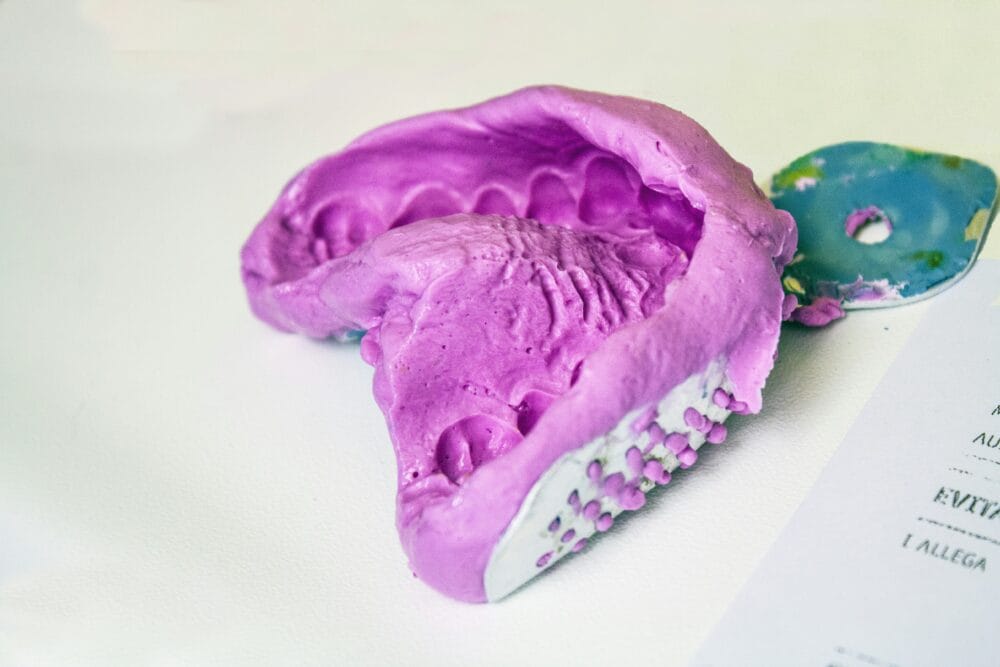 What to consider when taking dental impressions