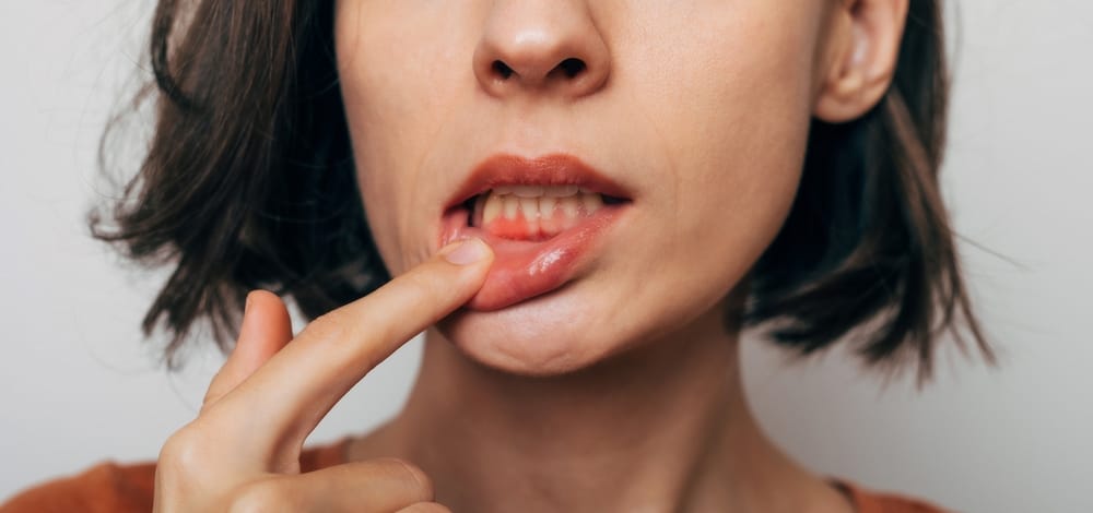 Osteoporosis and oral health: the intersection