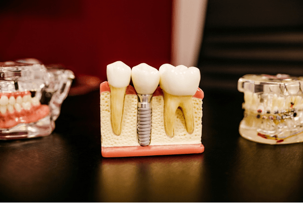 The evolution of endodontic efficiency