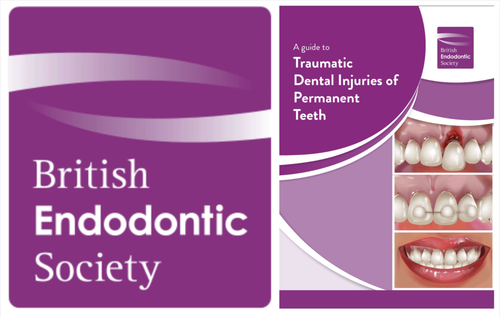 Reliable guidance and resources for dental trauma cases