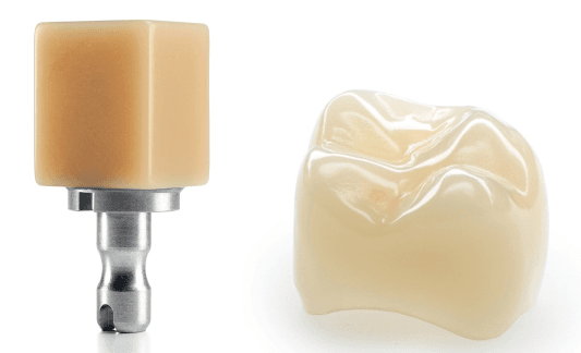 Beyond surgery – restoring implants with confidence