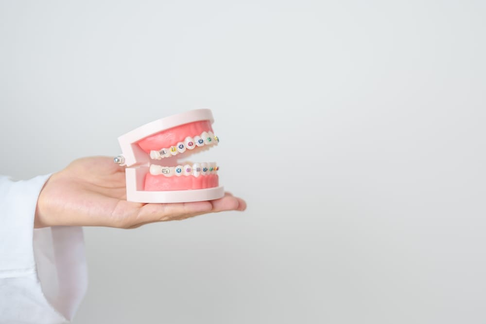 Support beyond toothbrushing for orthodontic patients