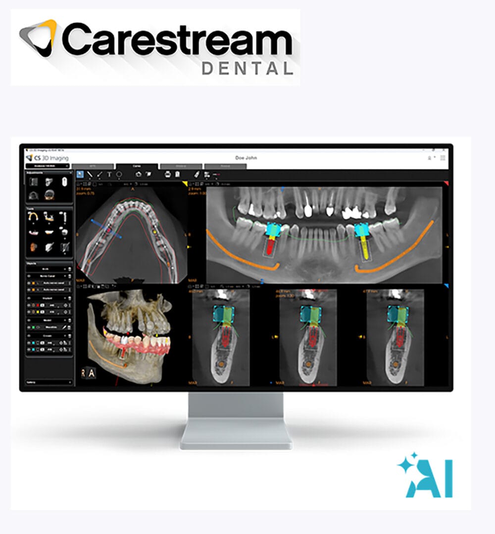 Implant meets AI with Carestream Dental