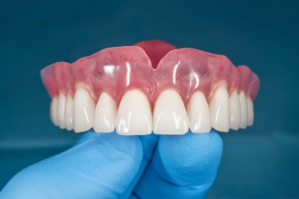 The hidden cost of time in conventional denture workflows