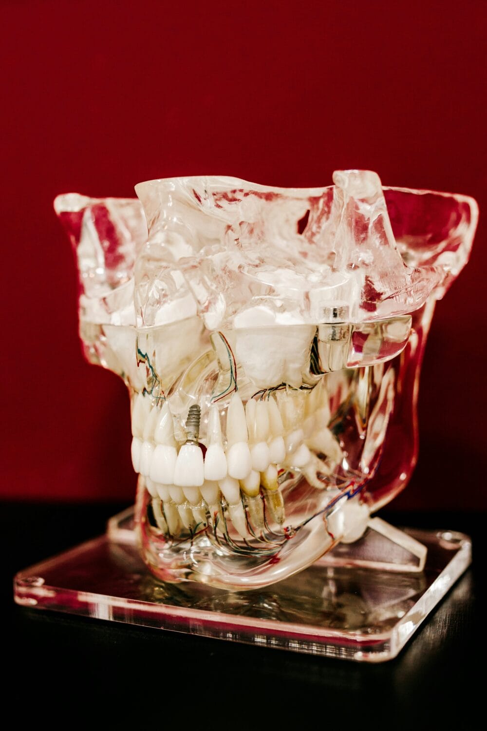 Dental implants – the biological and surgical complications