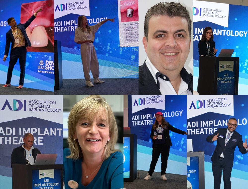 Dental implants take the stage