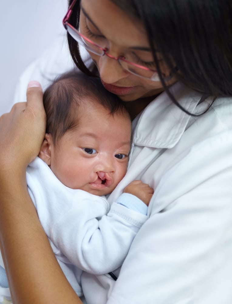 Cleft lip and palate – the oral health impact
