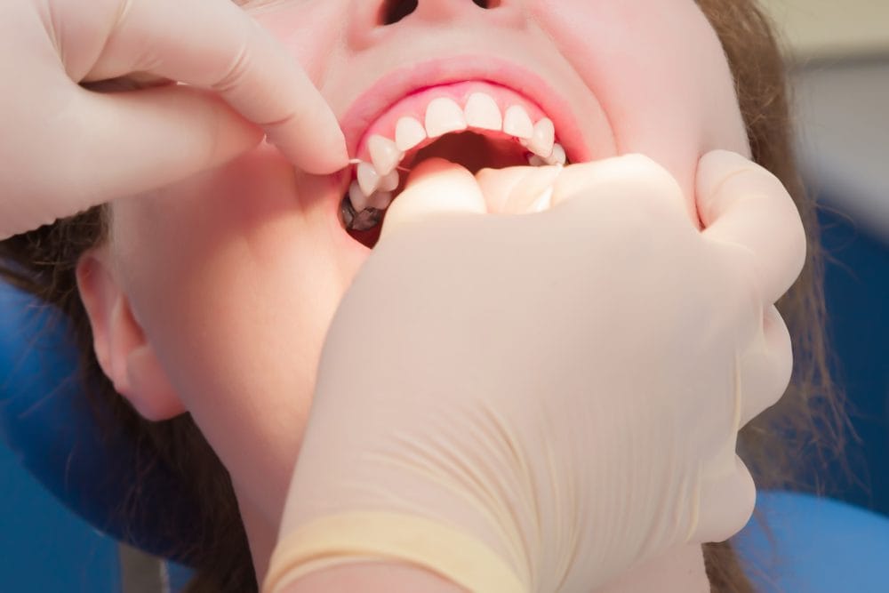 The new electric flosser that fills a decade-long gap