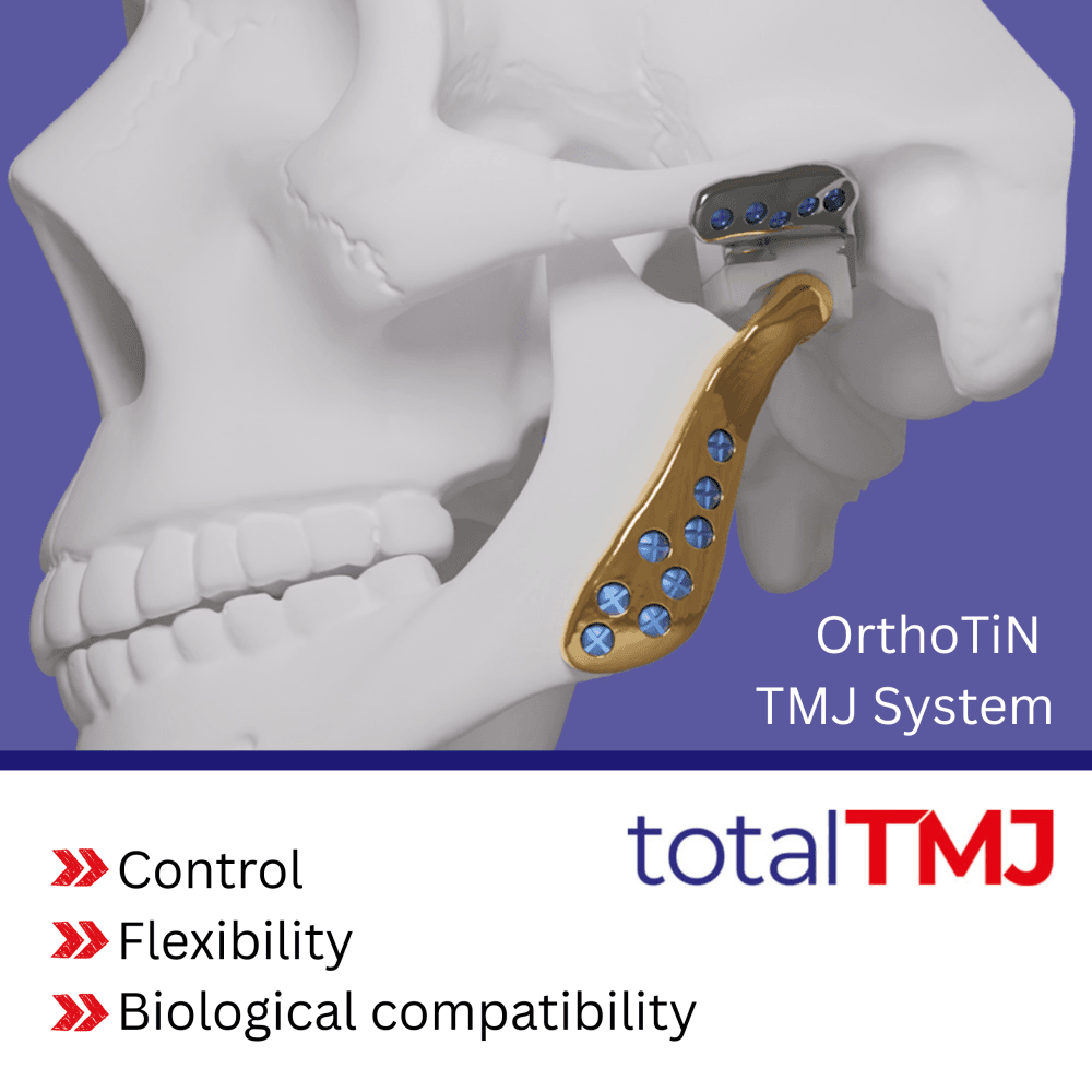 OrthoTiN: For precision joint replacement built around the patient.