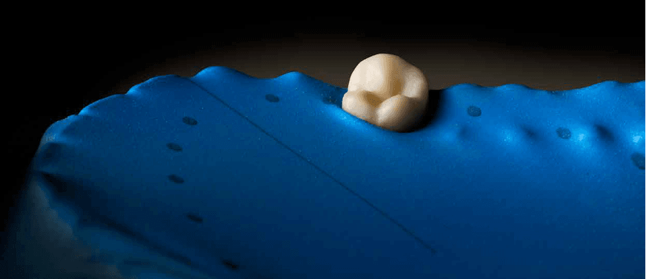 Faster isolation, confident retraction – the HySolate SyntX Dam from COLTENE