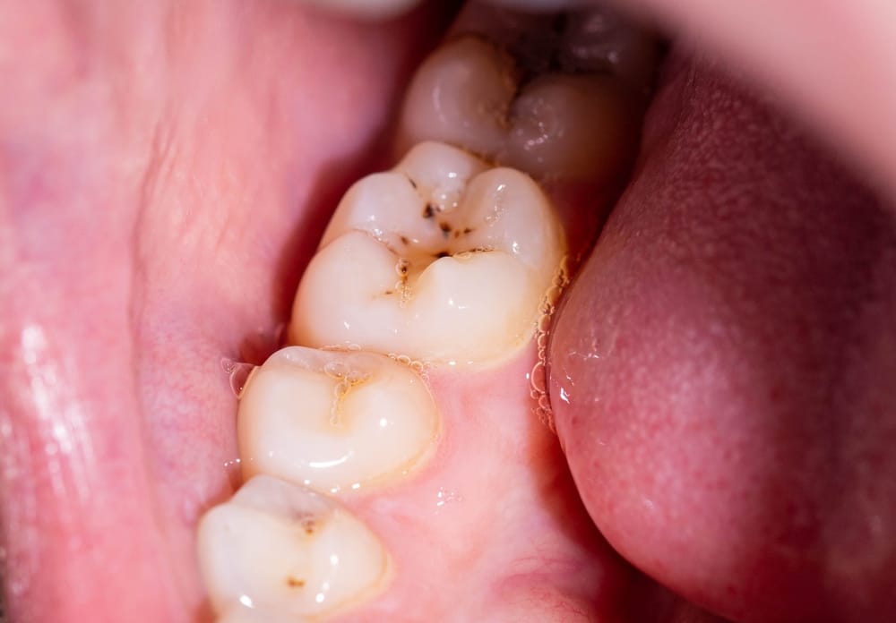 Achieving predictable adhesion under challenging bonding conditions