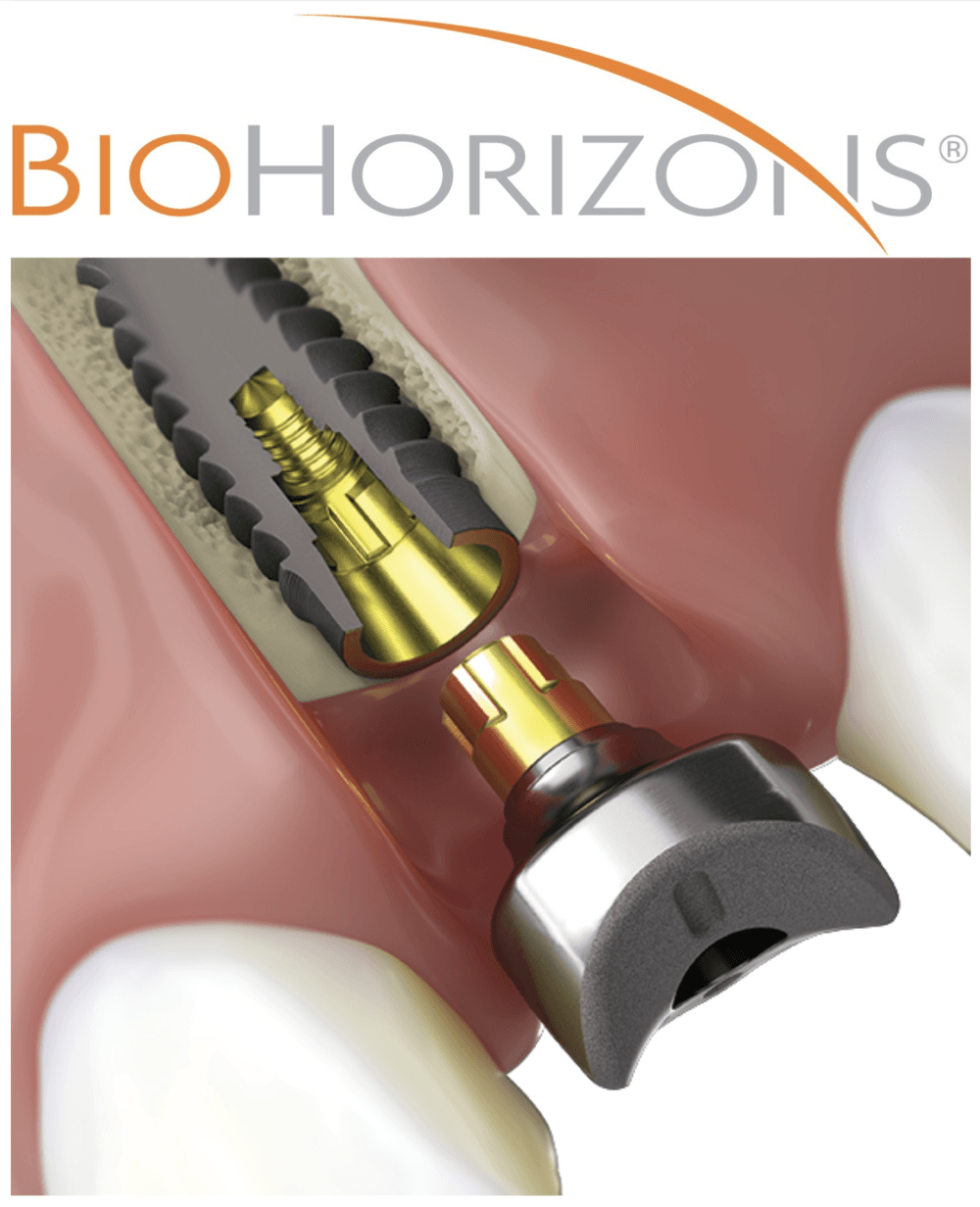 Choose BioHorizons for reduced treatment times