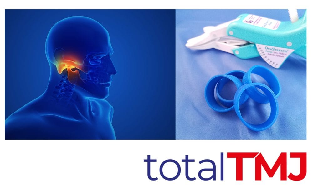 OraStretch range approved onto NHS Drug Tariff