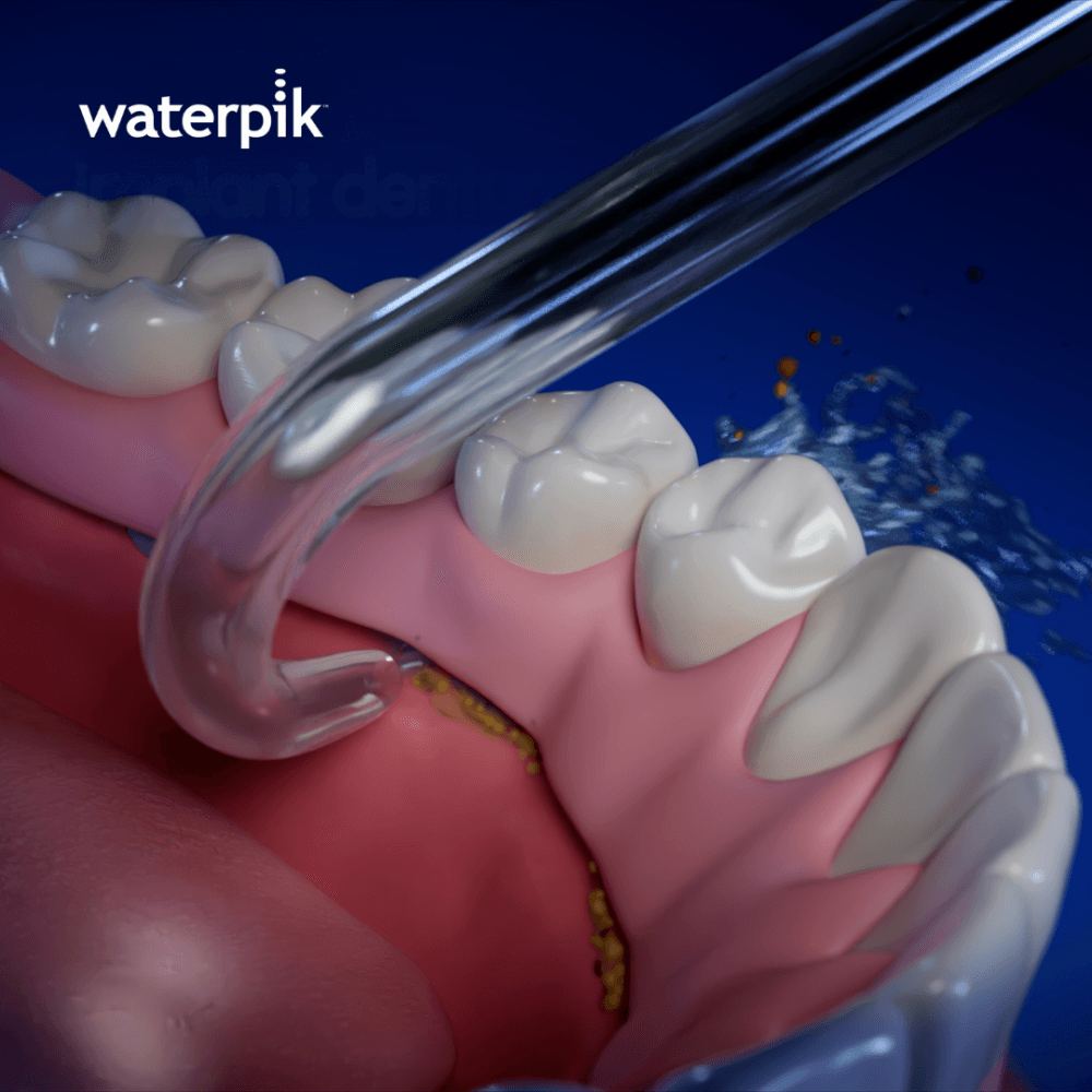 Elevating oral hygiene around implants