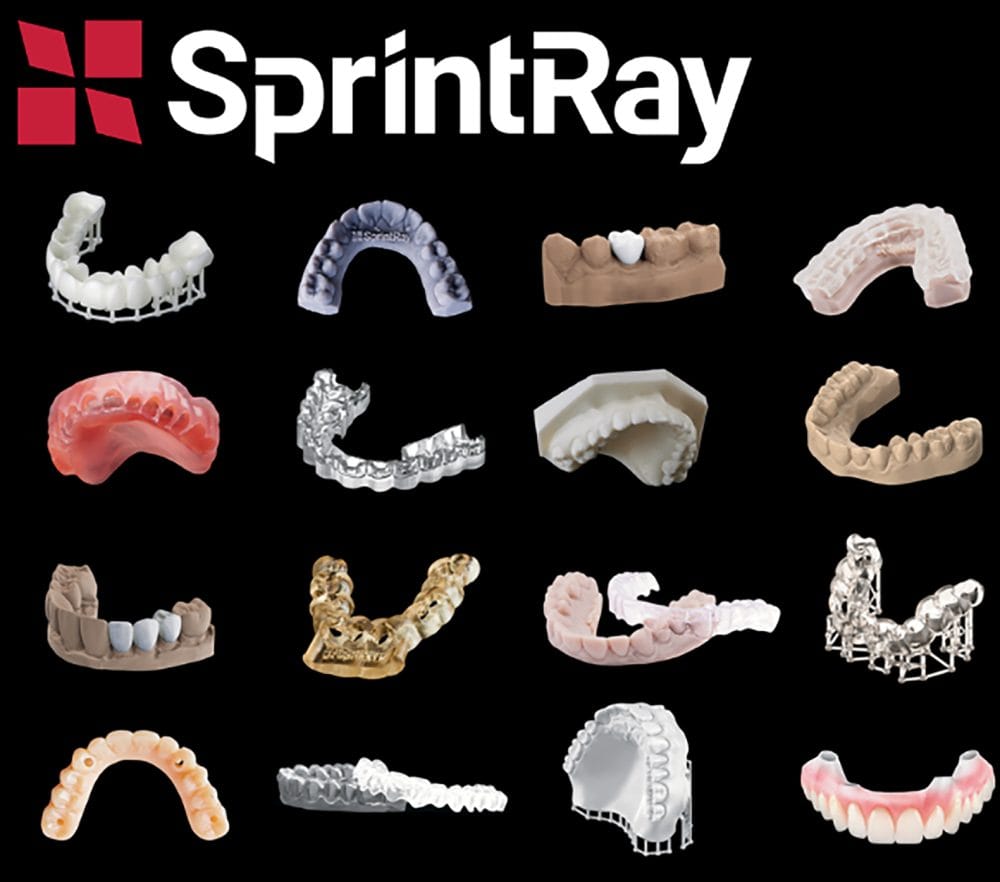 SprintRay resins: turnkey workflows for confident chairside printing